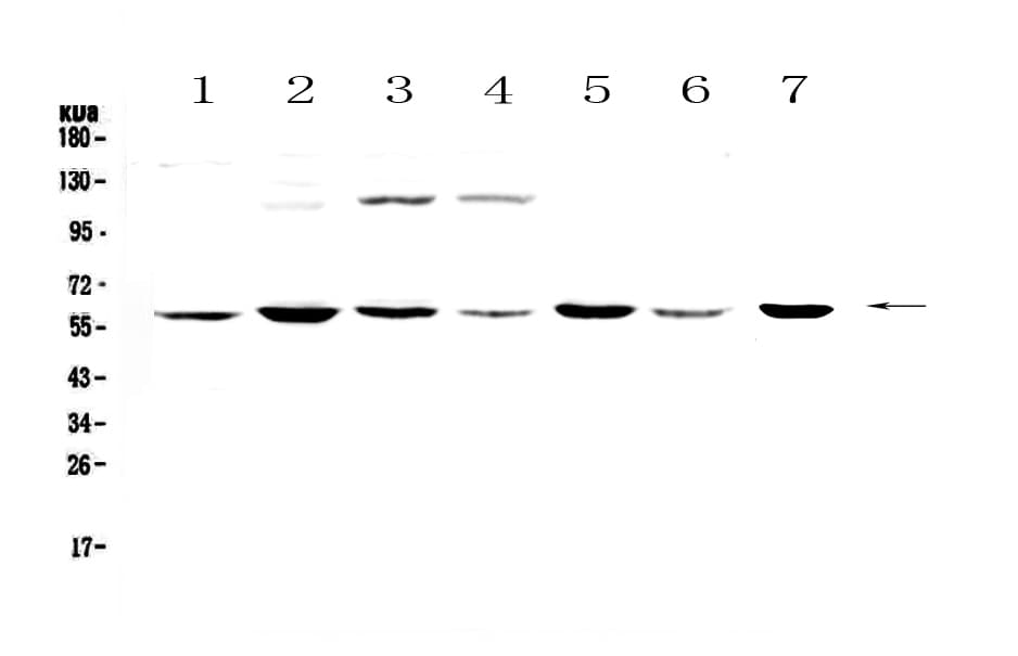 Polyclonal Rabbit anti-Human CHRNA3 Antibody (IHC, WB)