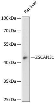 Polyclonal Rabbit anti-Human ZNF323 Antibody (WB)