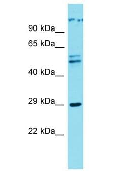 CWF19L1 Antibody (aa189-238)