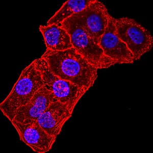 GRIK3 / GLUR7 Antibody (clone 2B3D1)