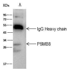 PSMB8 / LMP7 Antibody (Preservative Free)