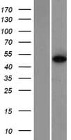 ZNF384 Protein (Over-Expression Lysate Myc-DDK (Flag))