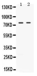 MAP3K7 / TAK1 Antibody