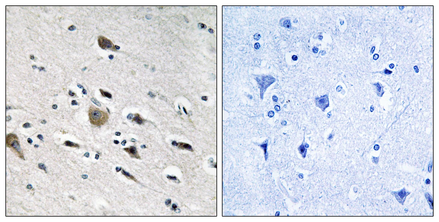 Polyclonal Rabbit anti-Human MRPL52 Antibody (aa71-120, IHC, IF)