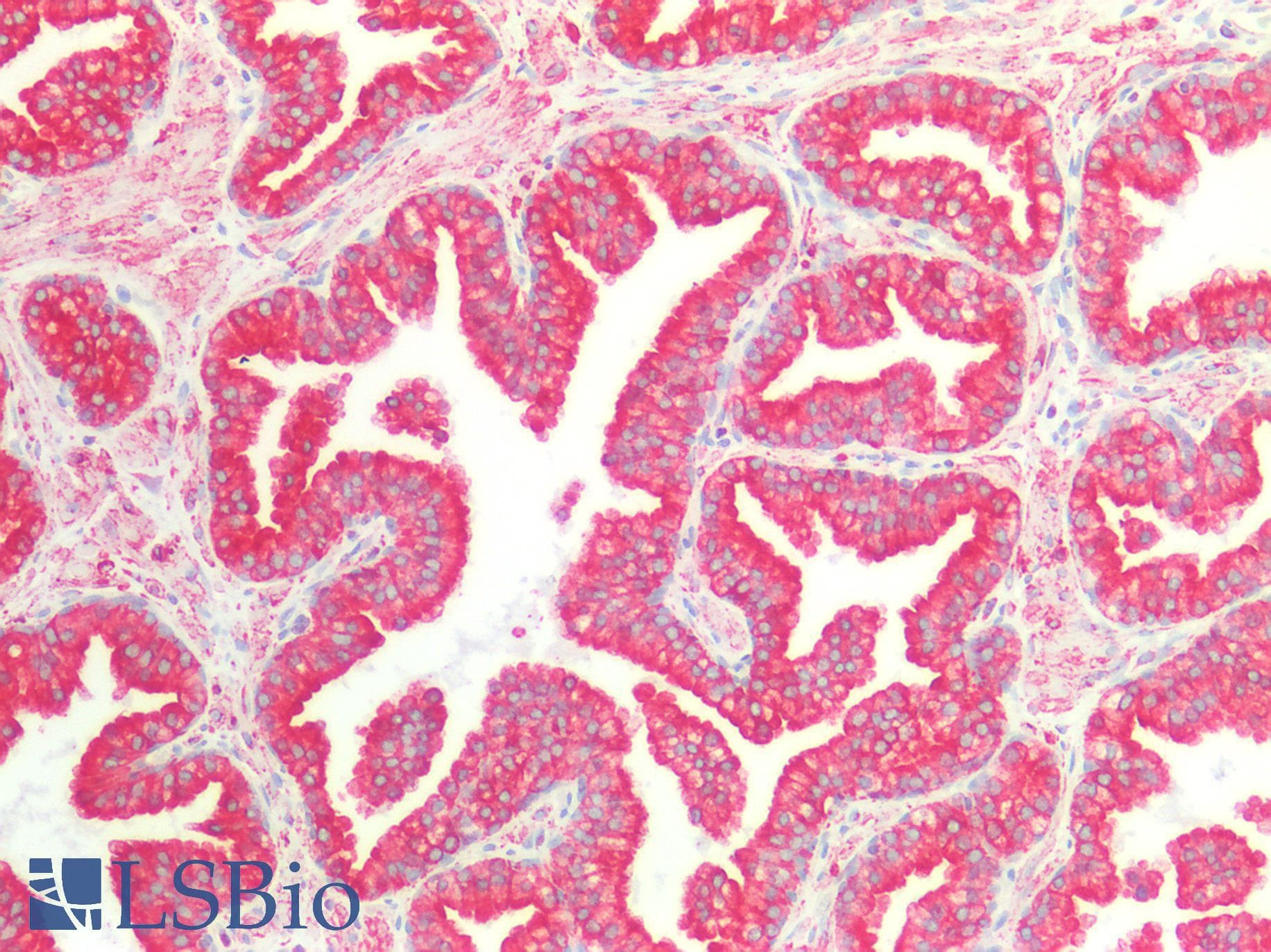PathPlus™ CANX / Calnexin Antibody (C-Terminus)