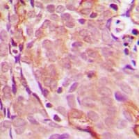 EDA / Ectodysplasin A Antibody (Internal)
