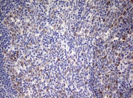 TOP2A / Topoisomerase II Alpha Antibody (aa1100-1531, clone OTI5E6, Carrier-free)