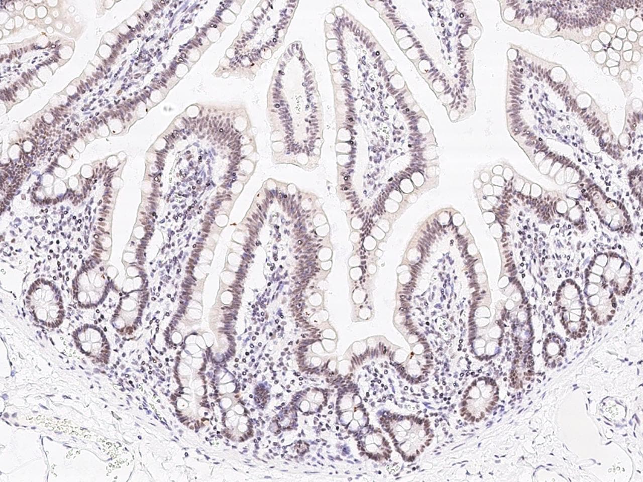 Polyclonal Rabbit anti-Human ZNF830 / CCDC16 Antibody (Preservative Free, IHC, IF, WB)