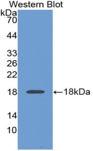 PDGF-BB Antibody (aa82-190)