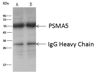 Polyclonal Rabbit anti-Human PSMA5 Antibody (Preservative Free, IHC, WB)