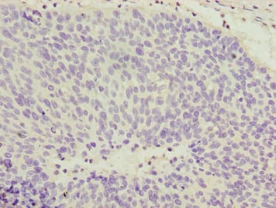 Polyclonal Rabbit anti-Human COPZ1 Antibody (IHC, WB)