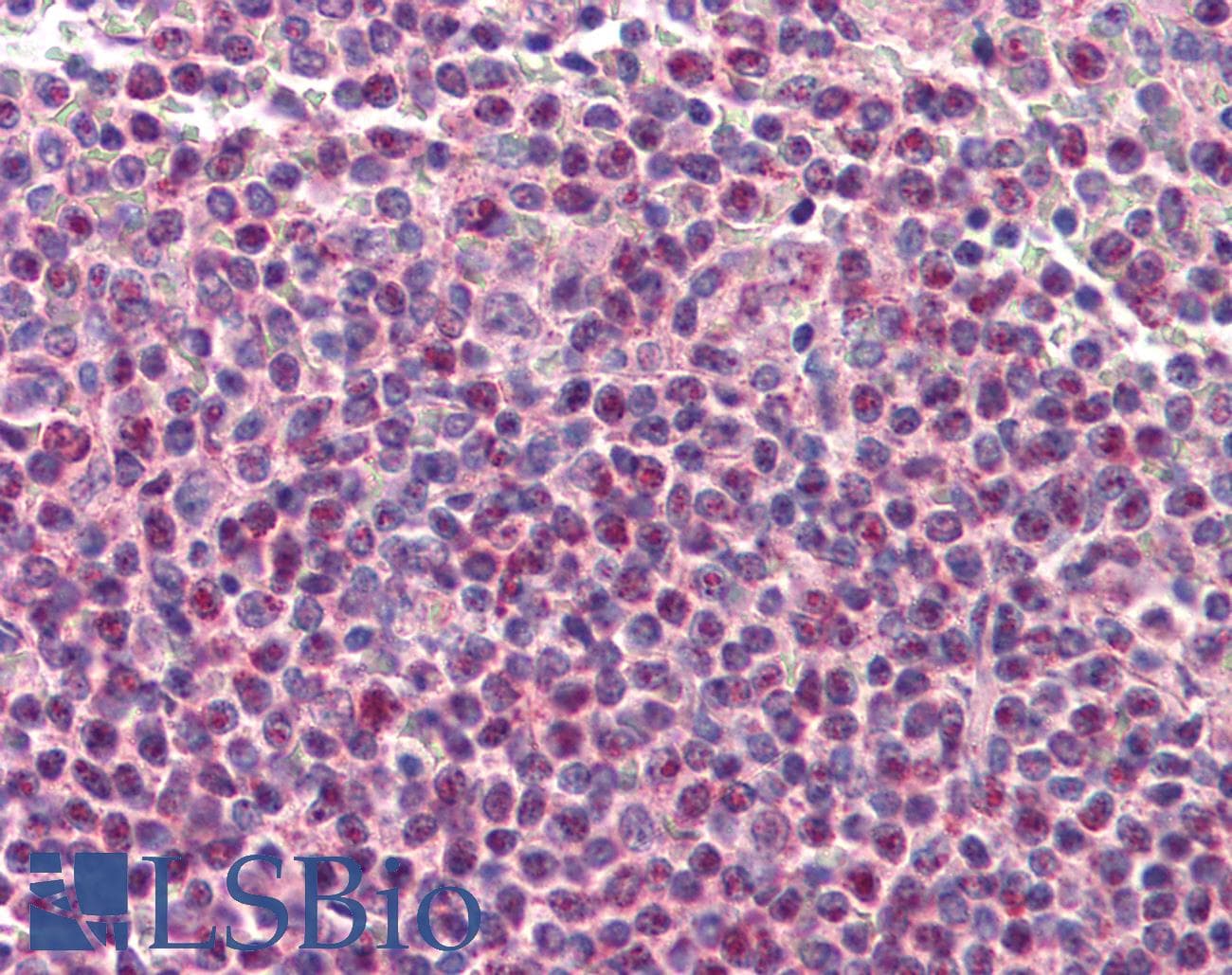 IHC-plus™ Polyclonal Rabbit anti-Human TNFRSF14 / CD270 / HVEM Antibody (IHC, IF, WB)