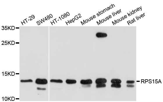 Polyclonal Rabbit anti-Human RPS15A Antibody (WB)