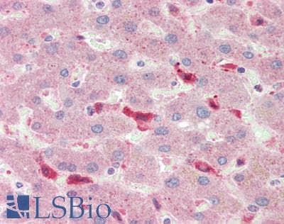 IHC-plus™ Polyclonal Rabbit anti-Human BCAT1 / ECA39 Antibody (IHC)