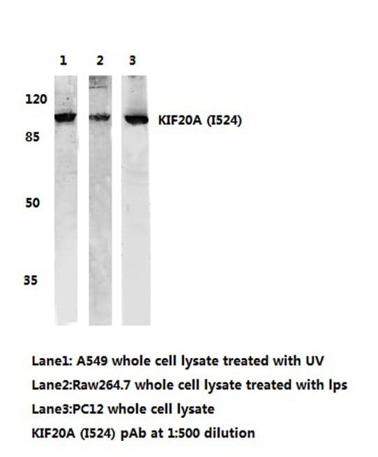 Polyclonal Rabbit anti-Human RAB6KIFL / KIF20A Antibody (Ile524, WB)