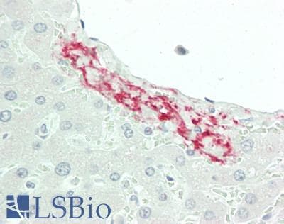 IHC-plus™ CFHR5 Antibody (aa203-231)