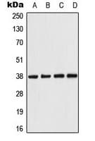 PRKAB1 / AMPK Beta 1 Antibody (N-Terminus)