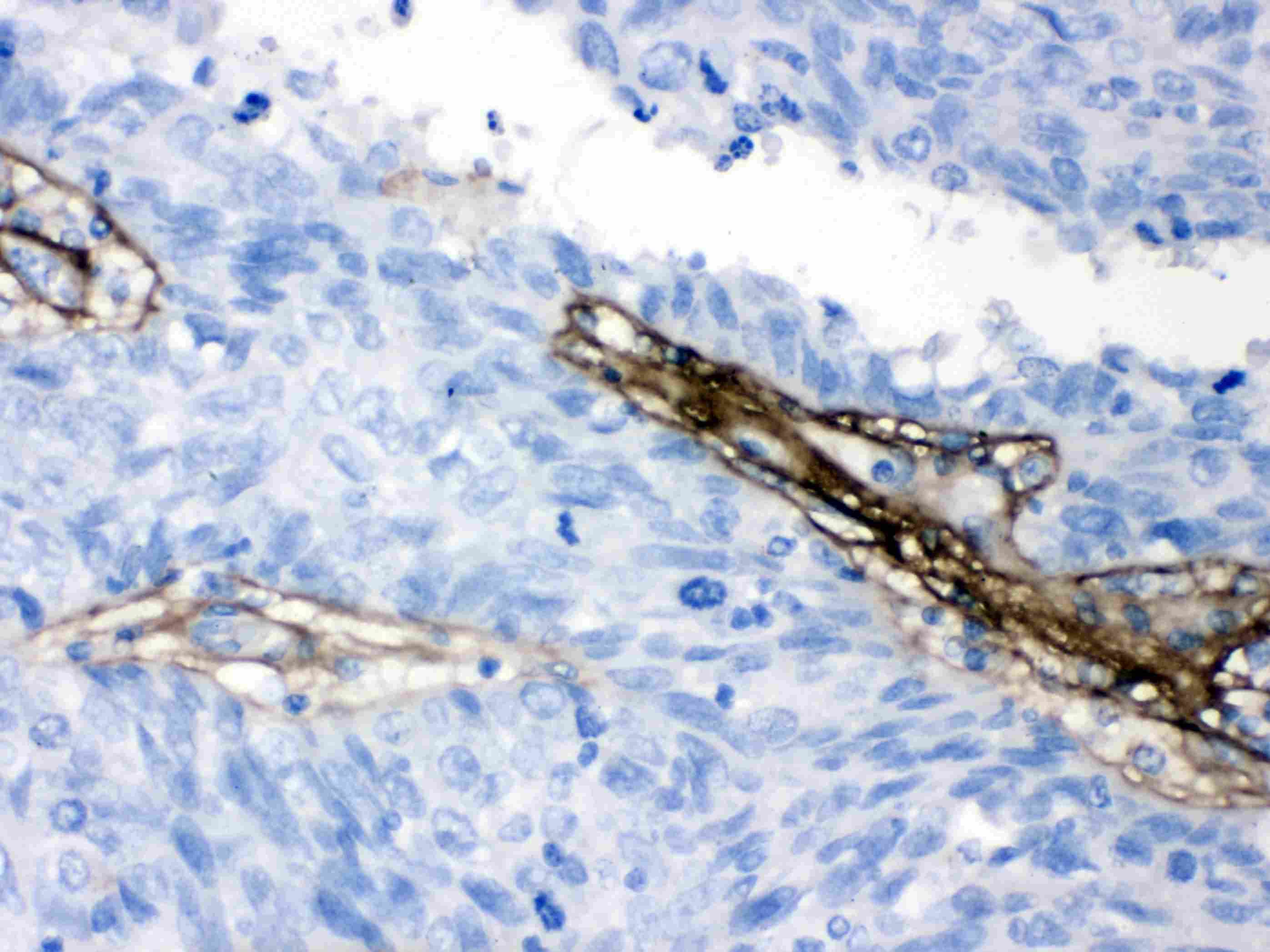 COL1A1 / Collagen I Alpha 1 Antibody