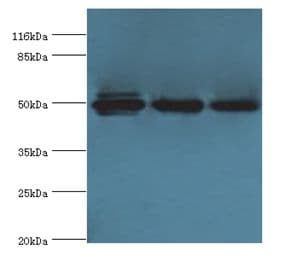 KRT38 / Keratin 38 / KRTHA8 Antibody (aa2-456, FITC)