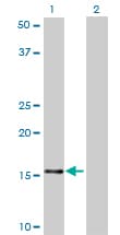 NDUFB7 / B18 Antibody (clone 4D4)