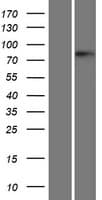 BRD4 Protein (Over-Expression Lysate Myc-DDK (Flag))