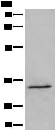 DIMT1L Antibody