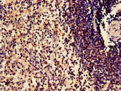 SLAMF1 / SLAM / CD150 Antibody