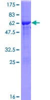 Human NTAN1 / PNAD Protein (Recombinant GST)