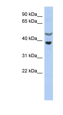 SOCS7 / SOCS-7 Antibody (aa35-84)