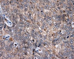 Monoclonal Mouse anti-Human APP / Beta Amyloid Precursor Antibody (clone OTI3E3, IHC, IF, WB)