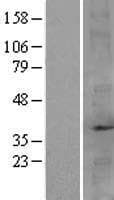 FBP2 Protein (Over-Expression Lysate Myc-DDK (Flag))