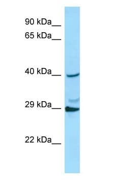 RAB3C Antibody (aa142-191)