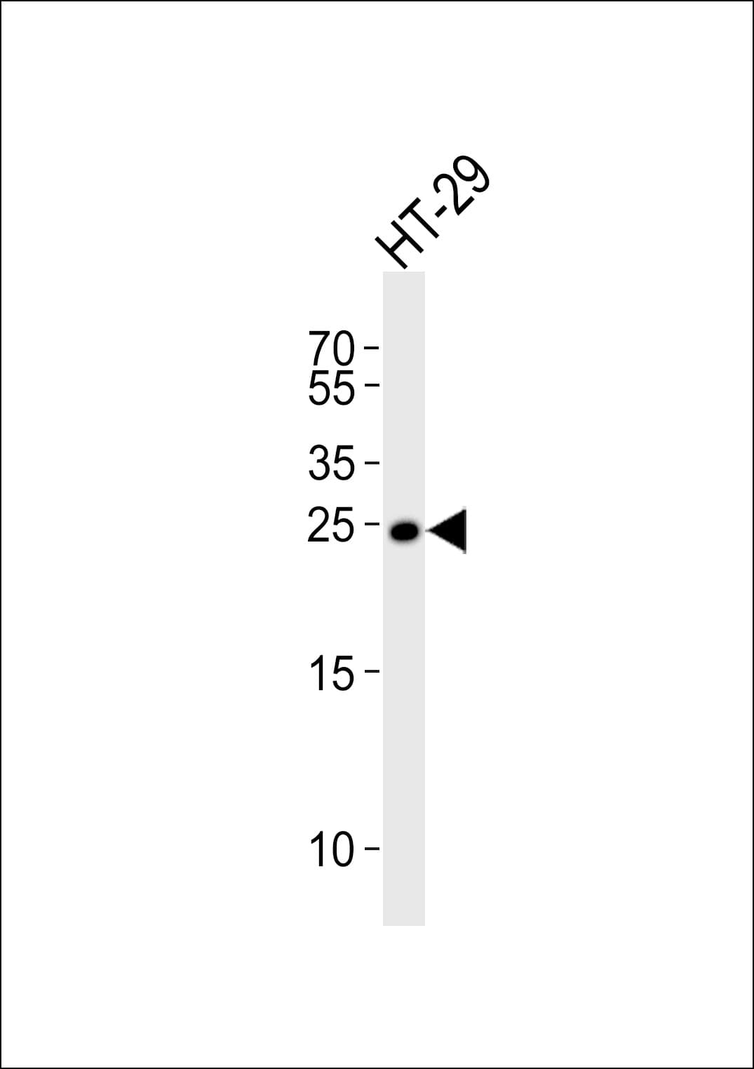 MAD2L1 / MAD2 Antibody (aa159-192)