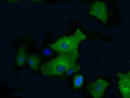 PFKFB4 Antibody (clone OTI1C8, Carrier-free)