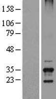 TSSK6 Protein (Over-Expression Lysate Myc-DDK (Flag))