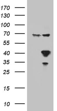 APOL1 / Apolipoprotein L Antibody (aa28-339, clone OTI1D8)
