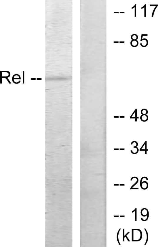 REL / C-Rel Antibody (aa470-519)