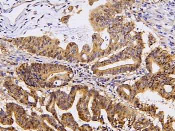 Polyclonal Rabbit anti-Human PPA1 Antibody (IHC, WB)
