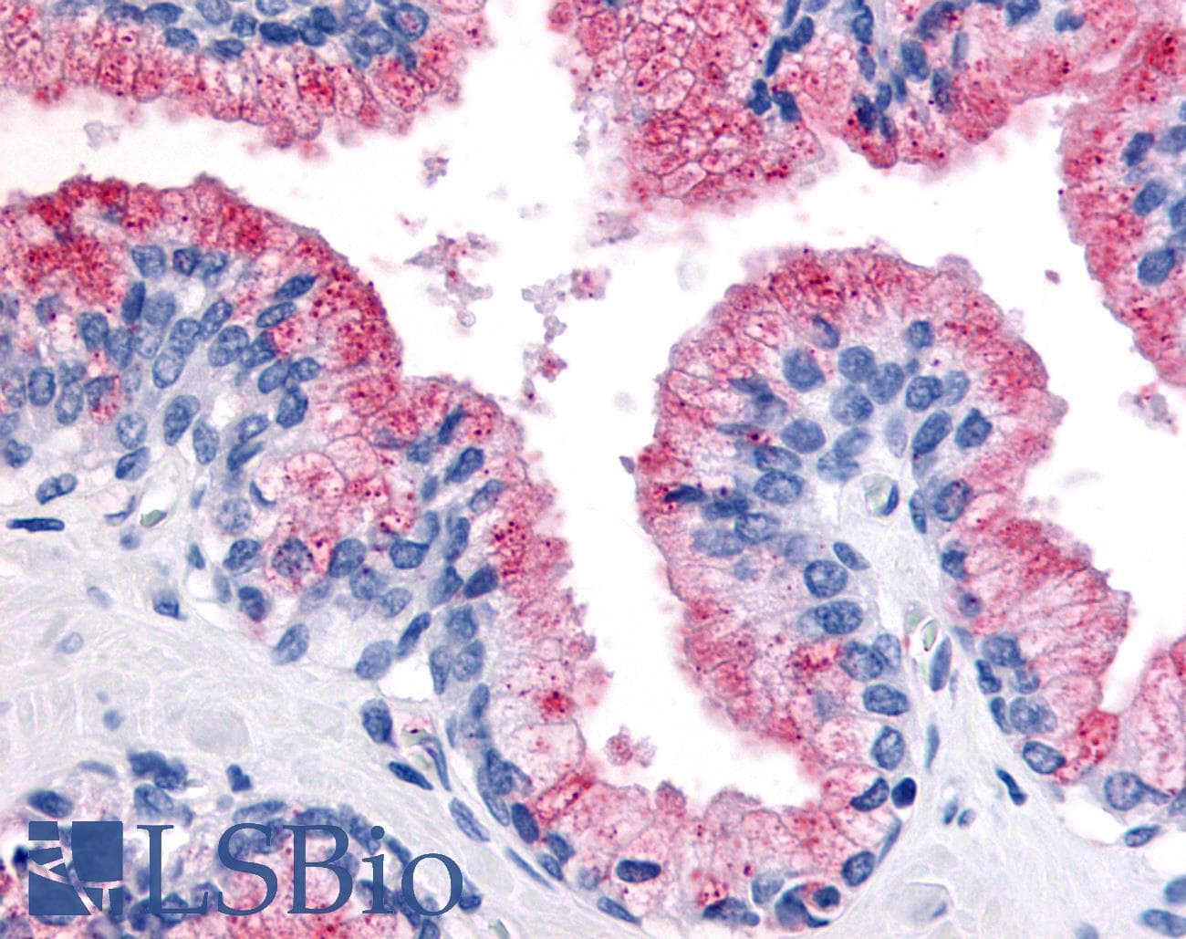 IHC-plus™ Polyclonal Rabbit anti-Human WNT8A Antibody (Internal, IHC)
