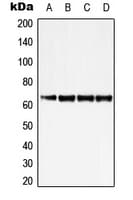 Polyclonal Rabbit anti-Human ZNF460 Antibody (C-Terminus, WB)