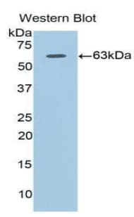ADIPOR1/Adiponectin Receptor 1 Antibody (aa1-136)