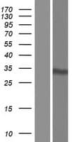 NOL7 / RARG-1 Protein (Over-Expression Lysate Myc-DDK (Flag))