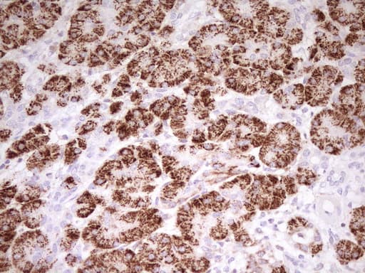 Monoclonal Mouse anti-Human ABAT Antibody (clone UMAB178, aa29-323, IHC, IF, WB)