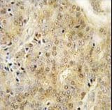 EZH1 / ENX-2 Antibody (aa393-422)