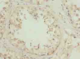 ZNF622 Antibody