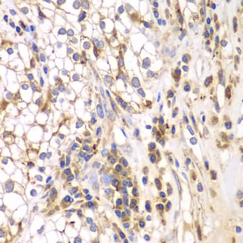 SRPK1 Antibody
