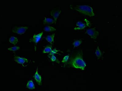 TM7SF3 Antibody