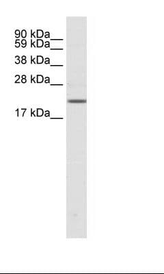 SCN3B Antibody (aa65-114)