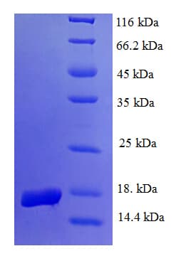 Human EGLN2 / PHD1 Protein (Recombinant His)