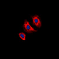 KDR / VEGFR2 / FLK1 Antibody (phospho-Tyr1175)
